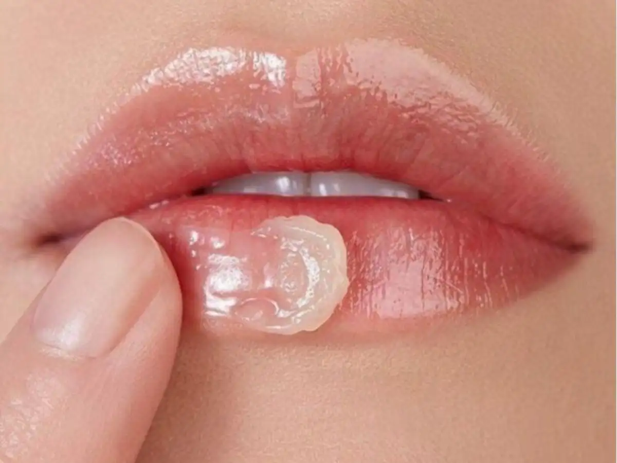 Bị dị ứng son môi nên bôi thuốc gì?