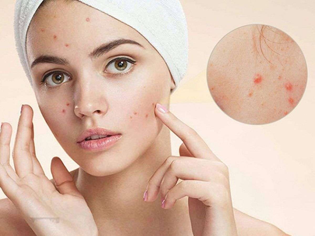 Kích thước hạt phấn rôm thường lớn hơn so với hạt phấn phủ chuyên dụng được bào chế riêng cho da mặt