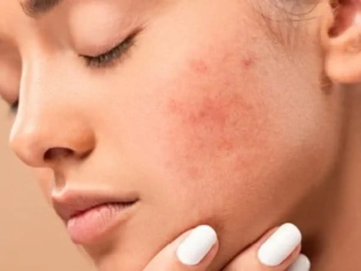 phấn rôm được thiết kế với mục đích chính là hút ẩm cho da em bé