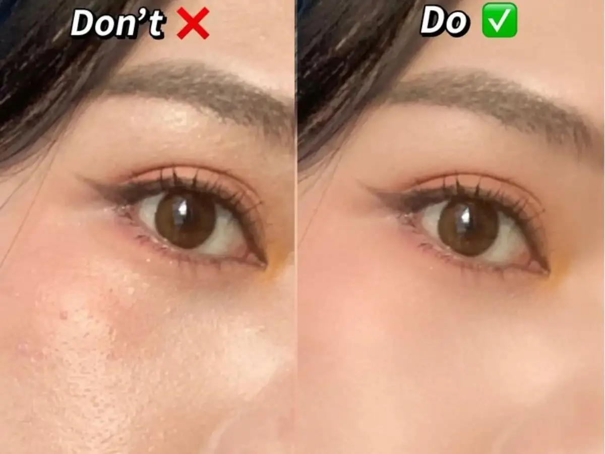 Đặc điểm da khô và lý do lớp nền thường bị mốc