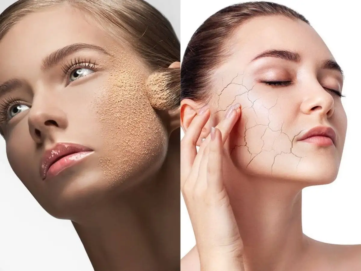 Lỗi nền mốc thường xảy ra ở da khô