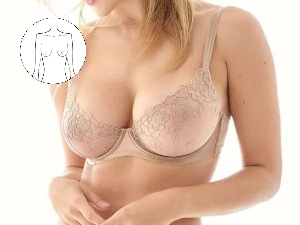 Ngực cách xa nhau có khoảng cách rộng giữa hai bầu ngực