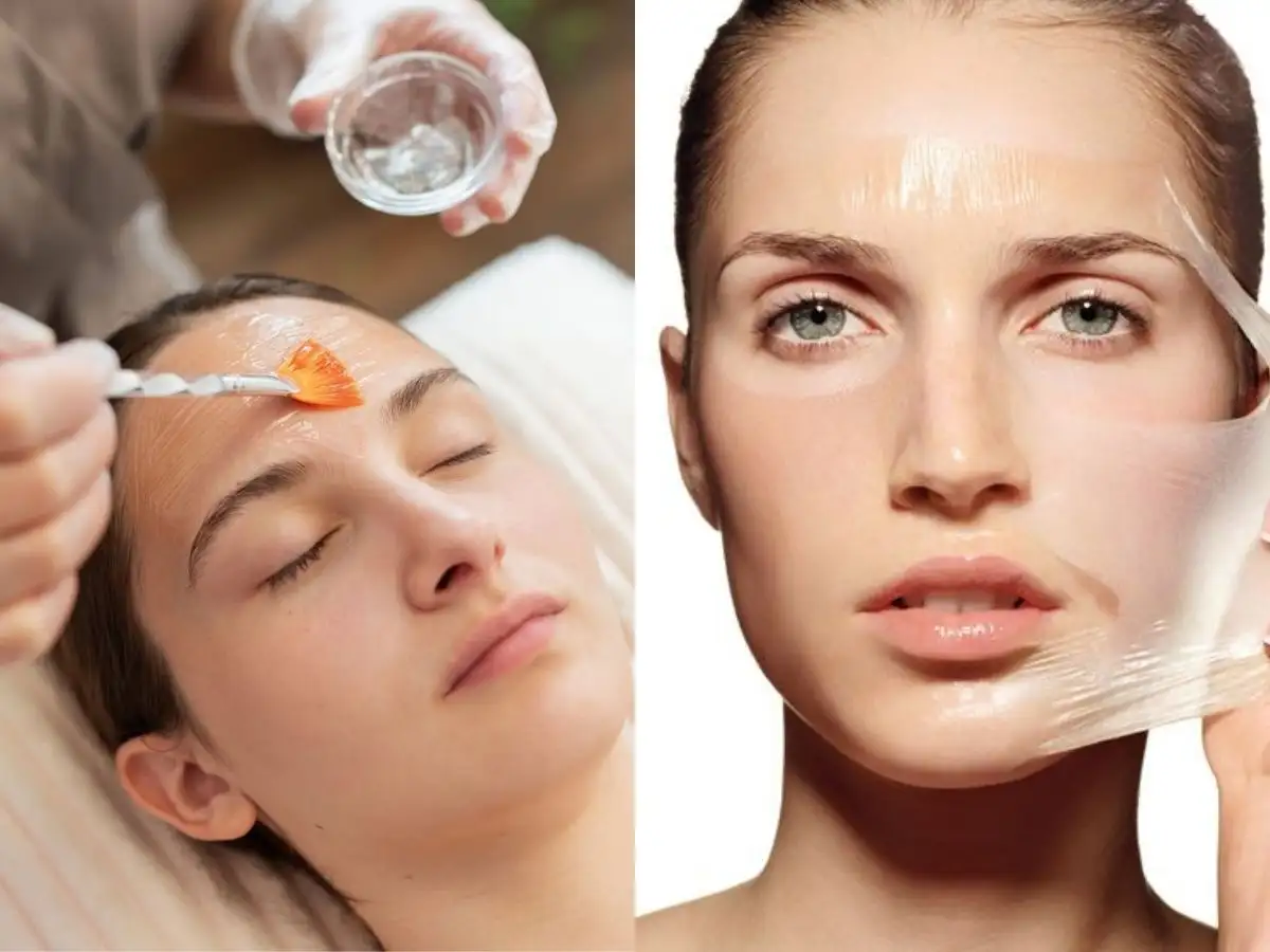 Định nghĩa peel da là gì?