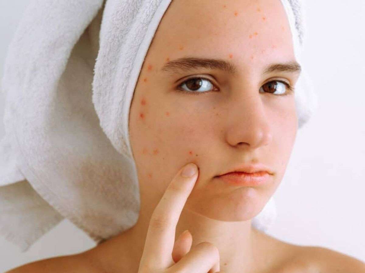 Phấn nước có thể gây bí da, nổi mụn nếu bạn chọn loại không hợp với da