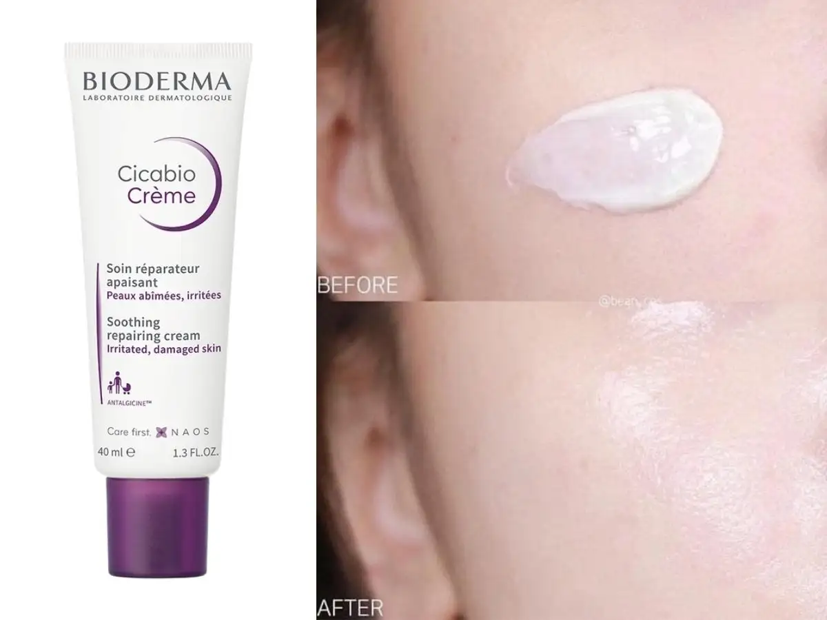 Bioderma Cicabio Crème là lựa chọn hoàn hảo cho da sau tổn thương