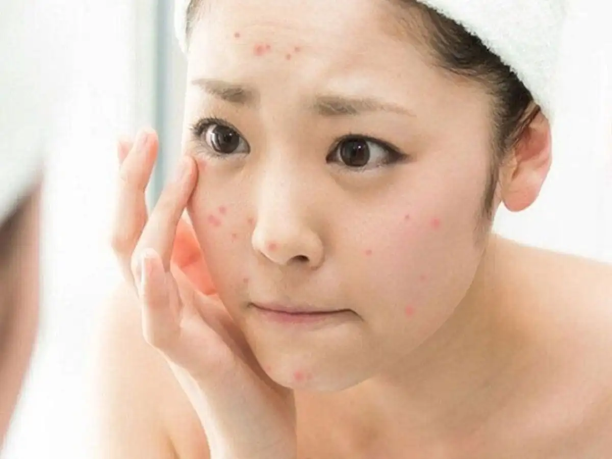 Gây kích ứng khi chọn sai thành phần kem lót