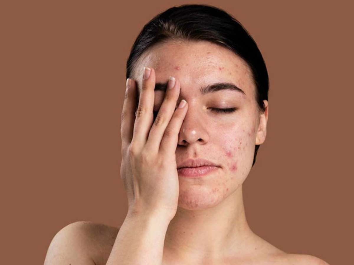 Nguyên nhân và dấu hiệu của làn da nhạy cảm 