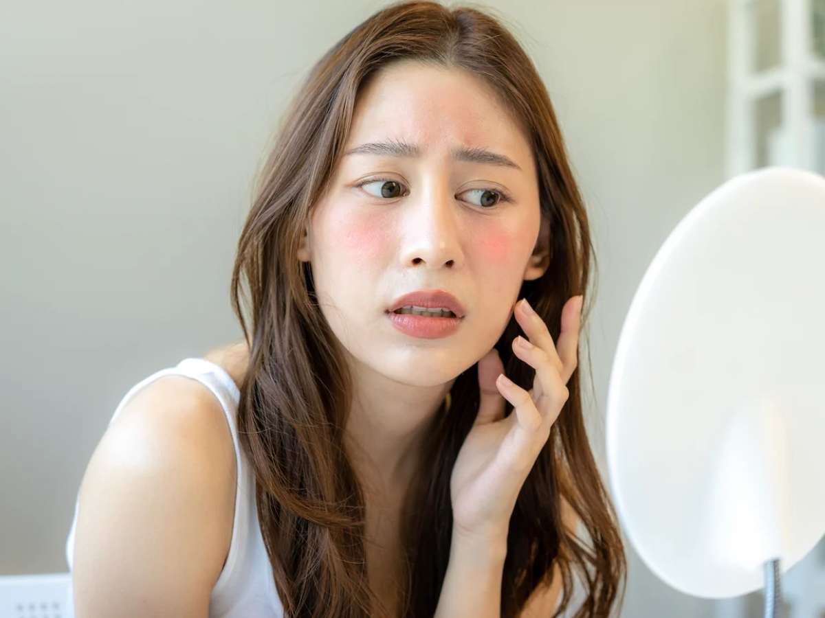 Làn da nhạy cảm cần lựa chọn sữa rửa mặt phù hợp