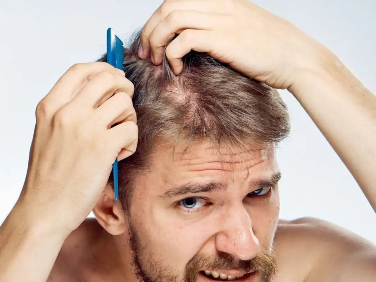 Tóc trở nên yếu hơn và nhạy cảm hơn sau khi tẩy