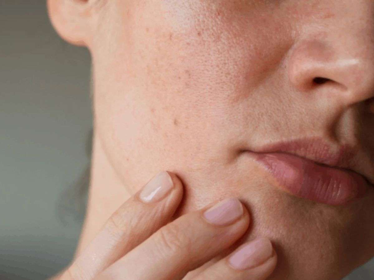 Da khô mụn nên ưu tiên các sản phẩm có thành phần lành tính, không chứa cồn khô 