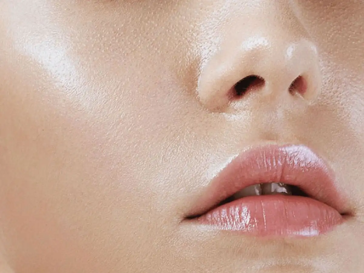 Da dầu lúc nào cũng bóng nhờn, đặc biệt ở vùng chữ T