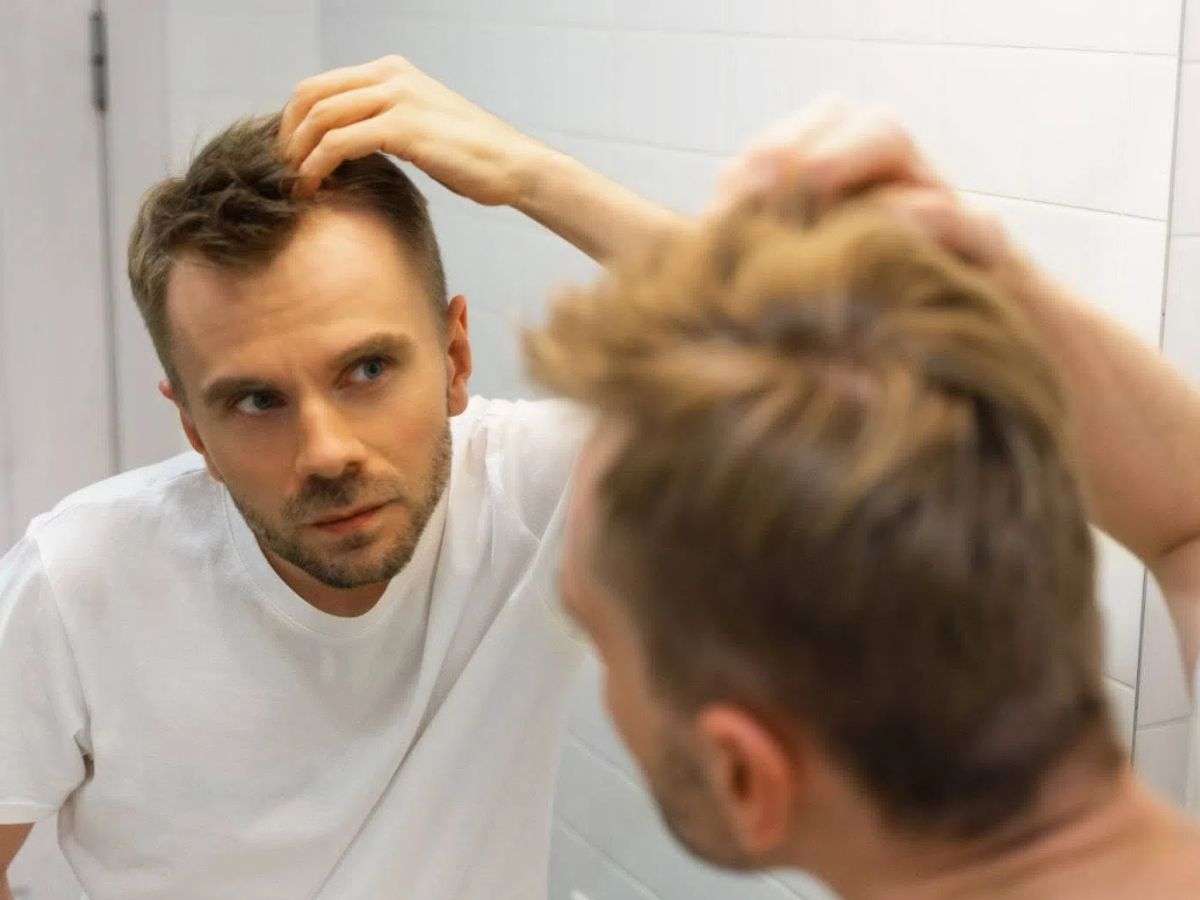 Có rất nhiều nguyên nhân gây ra rụng tóc ở nam giới