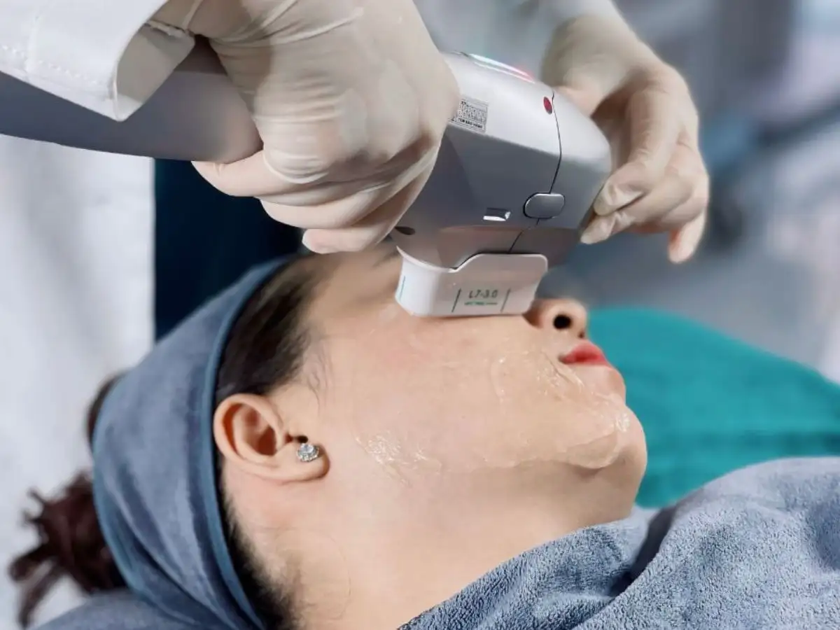 Ngoài ra, một số loại hình thẩm mỹ công nghệ cao khác cũng được các chị em áp dụng