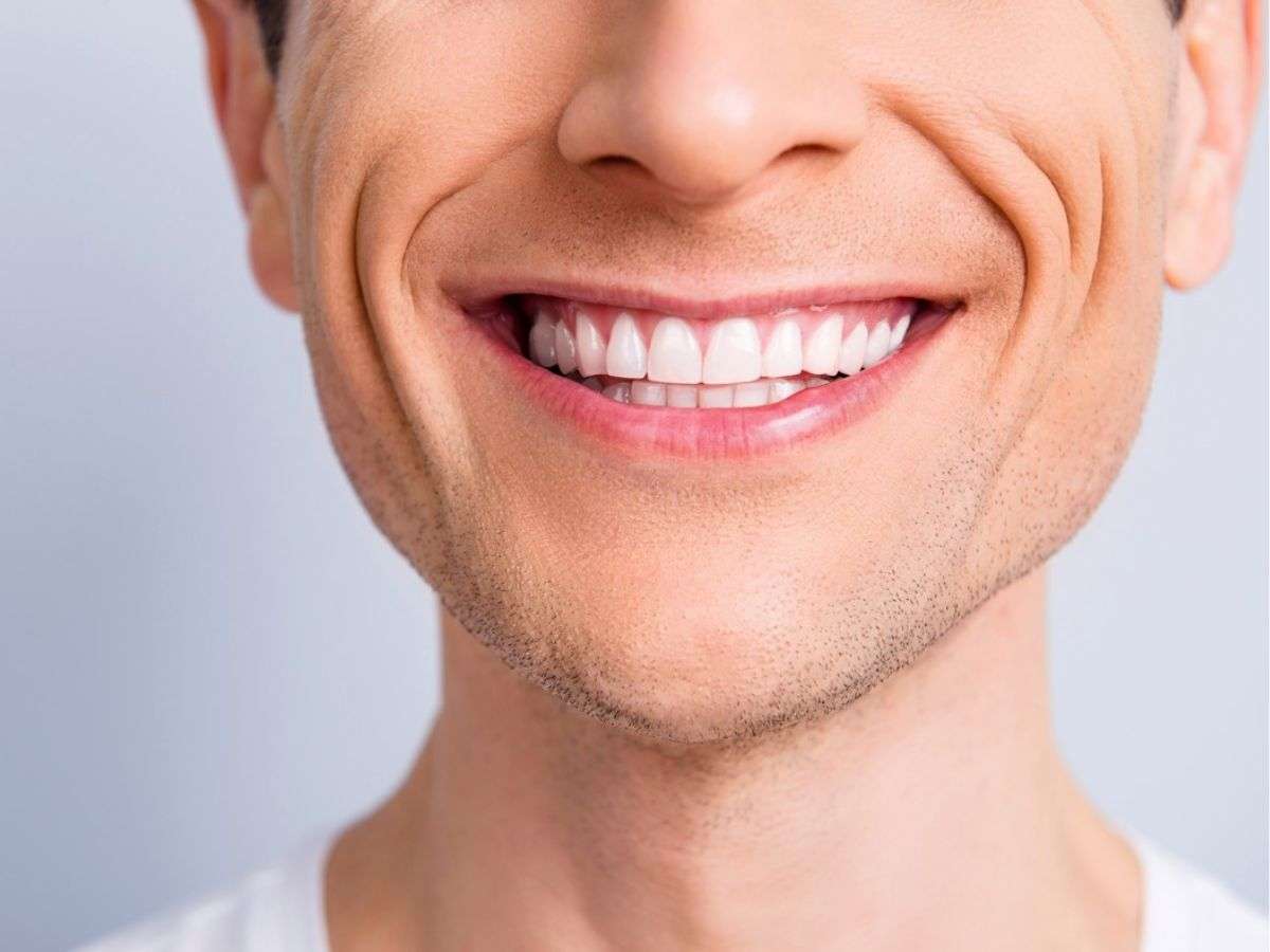 Nếp nhăn khóe miệng không hề phân biệt giới tính