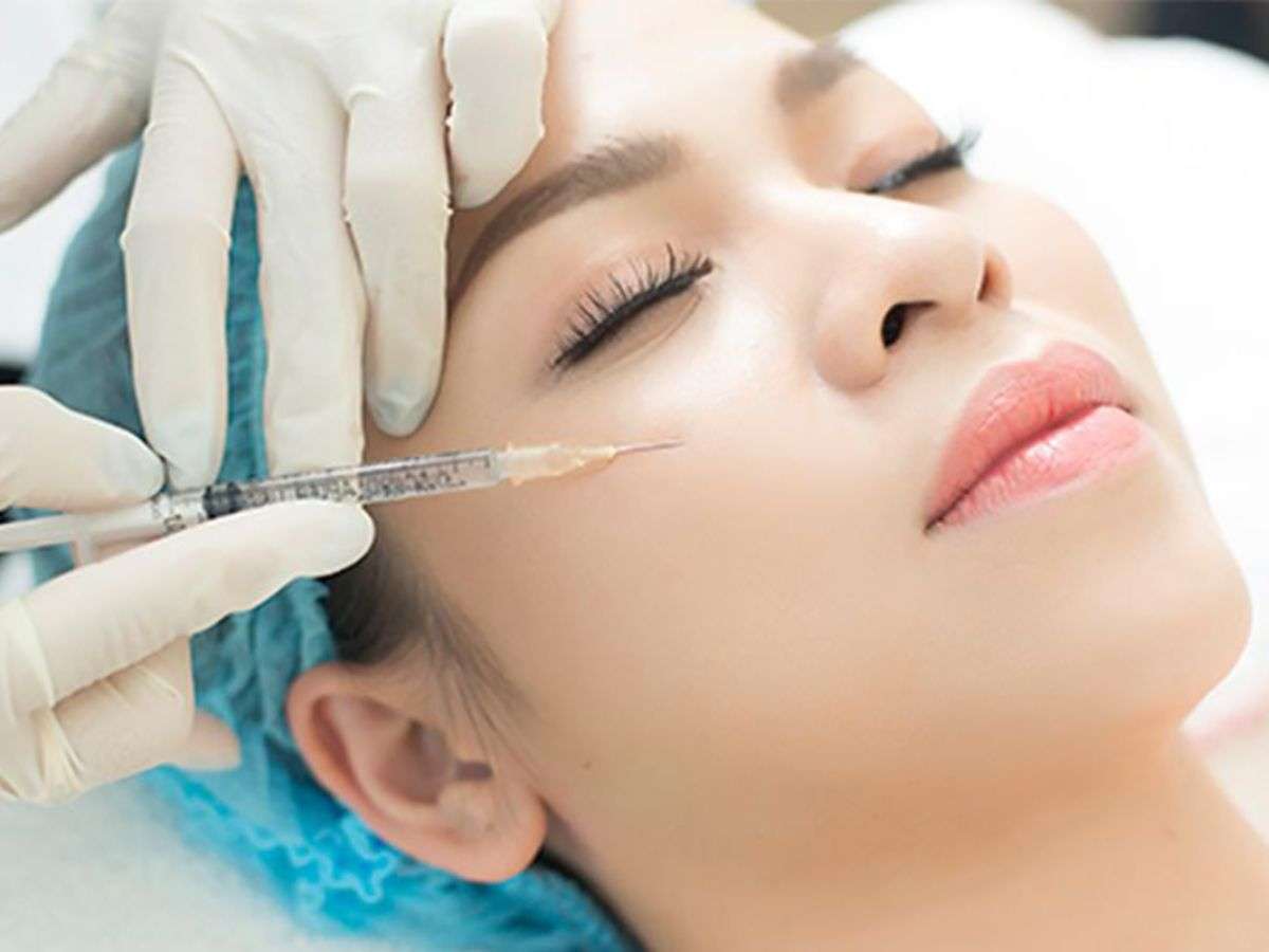 Tiêm filler - một phương pháp mì ăn liền để xóa rãnh cười