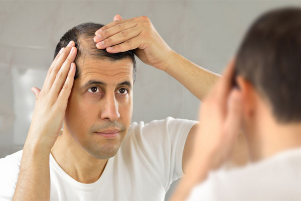 Rụng tóc từng mảng có phải bệnh lý? Cách khắc phục hiệu quả tới 99.9%