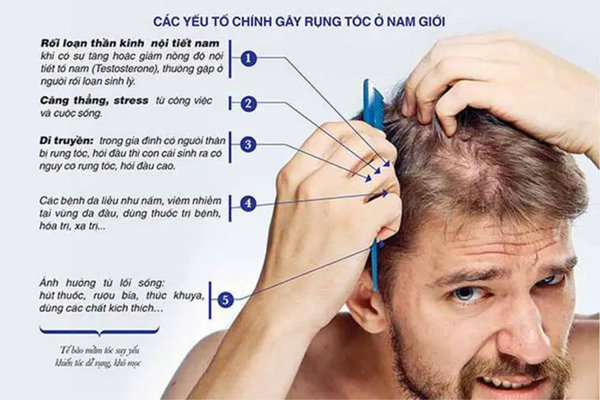 Ngăn ngừa rụng tóc ở nam giới và nữ giới  Có gì khác biệt
