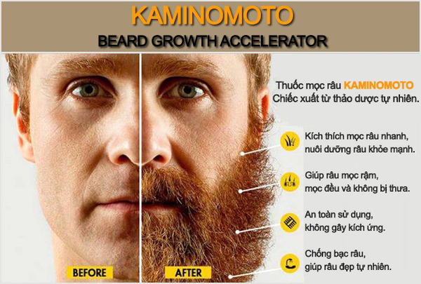 Sử dụng một số chất bổ sung để nuôi râu quai nón