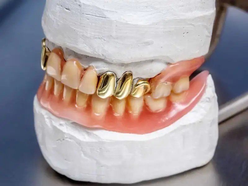 việc vệ sinh Grillz đúng cách cũng rất quan trọng