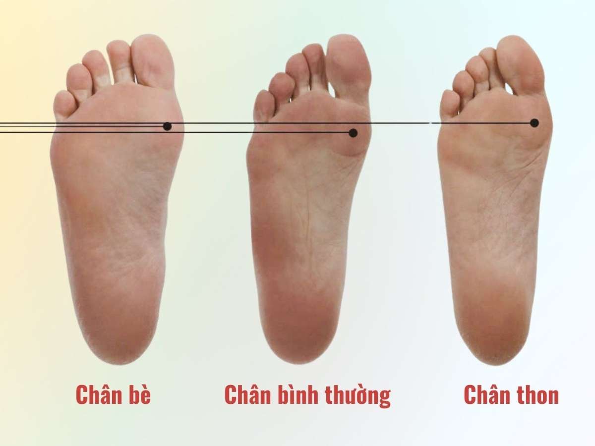 Cách nhận biết chân bè đơn giản tại nhà