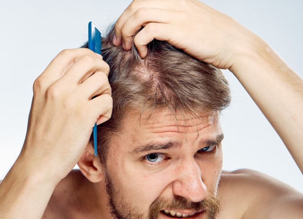 10 cách giảm rụng tóc cho nam cực hiệu quả áp dụng ngay - Cool Mate