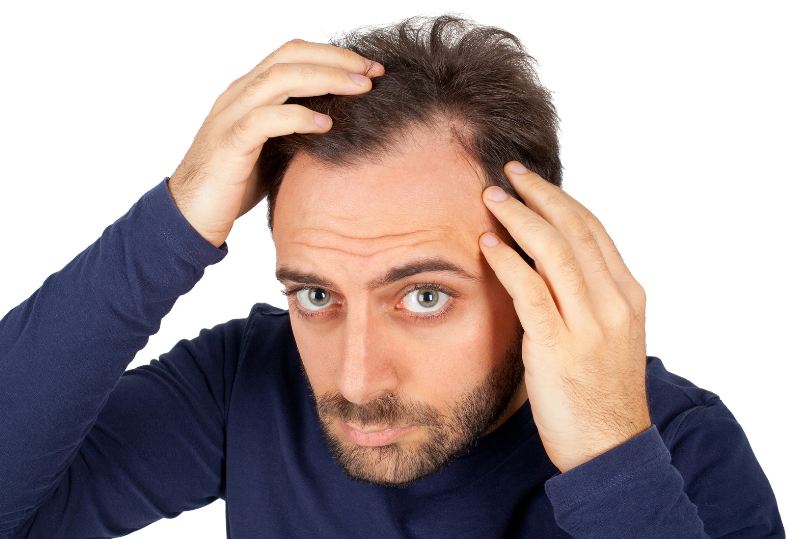 Tác dụng phụ của thuốc cũng là nguyên nhân khiến nam giới bị rụng tóc